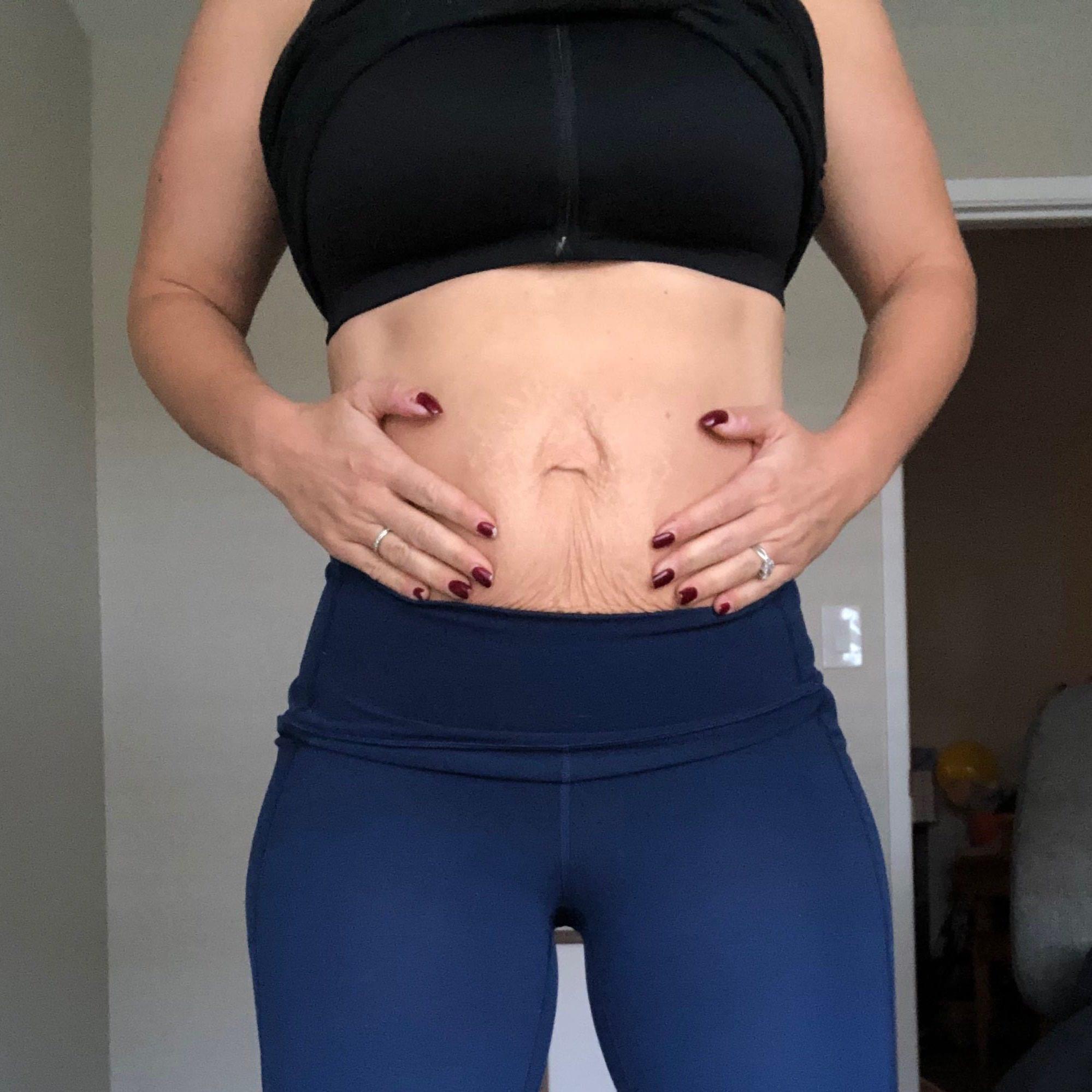 Diastasis & Athleticism